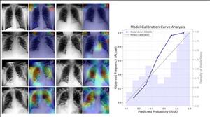 New Publication on Multimodal Machine Learning for ICU Admission Prediction